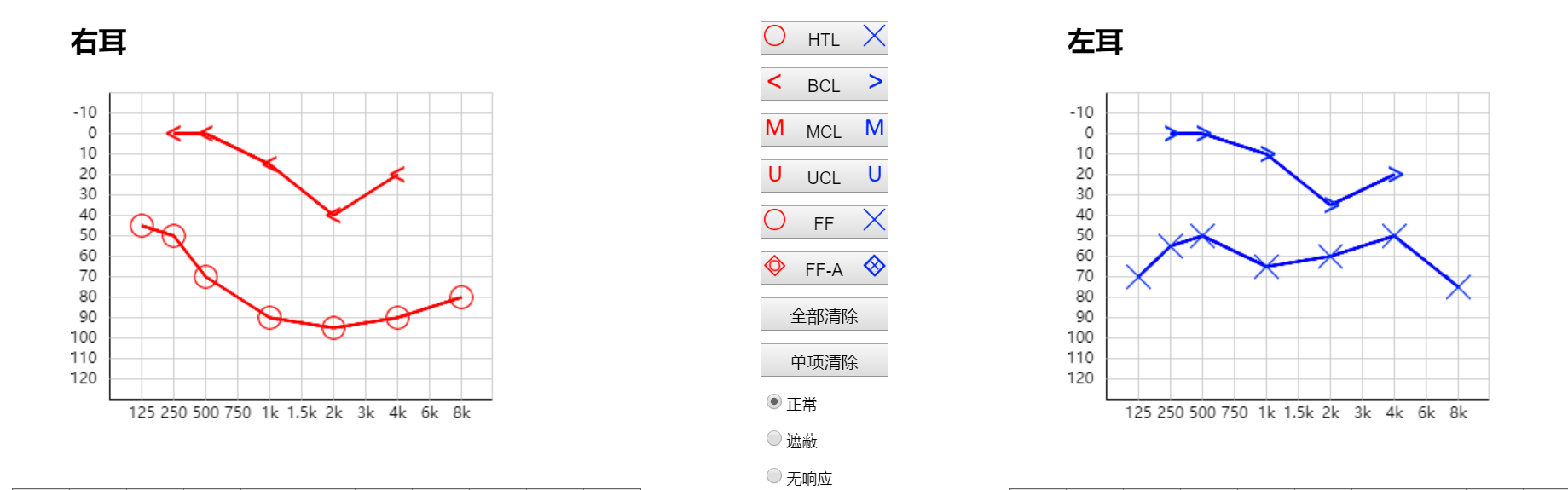 听管家|聆康·听觉有道全生命周期数字化听力健康管理平台(图5) QQ20260707-105334.png